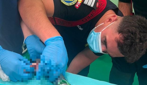 Un copil de doi ani a rămas cu mâna prinsă într-o mașină de tocat. Pompierii au demontat aparatul în sala de operații