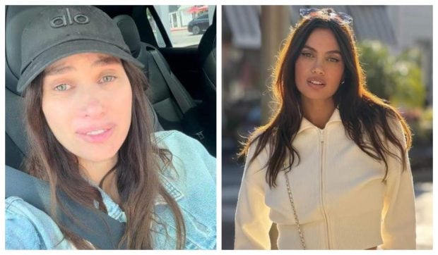 Alina Pușcău, model internațional și fostă concurentă „Asia Express”, diagnosticată cu o boală gravă și primește tratament la UCLA