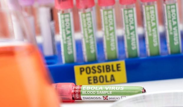 Epidemia de Ebola în 2026: Peste 2.700 de morți în Congo. Avertismentul prof. dr. Cristian Apetrei: „Numărul real de cazuri ar putea fi între 10.000 și 15.000. Epidemia este o problemă globală”
